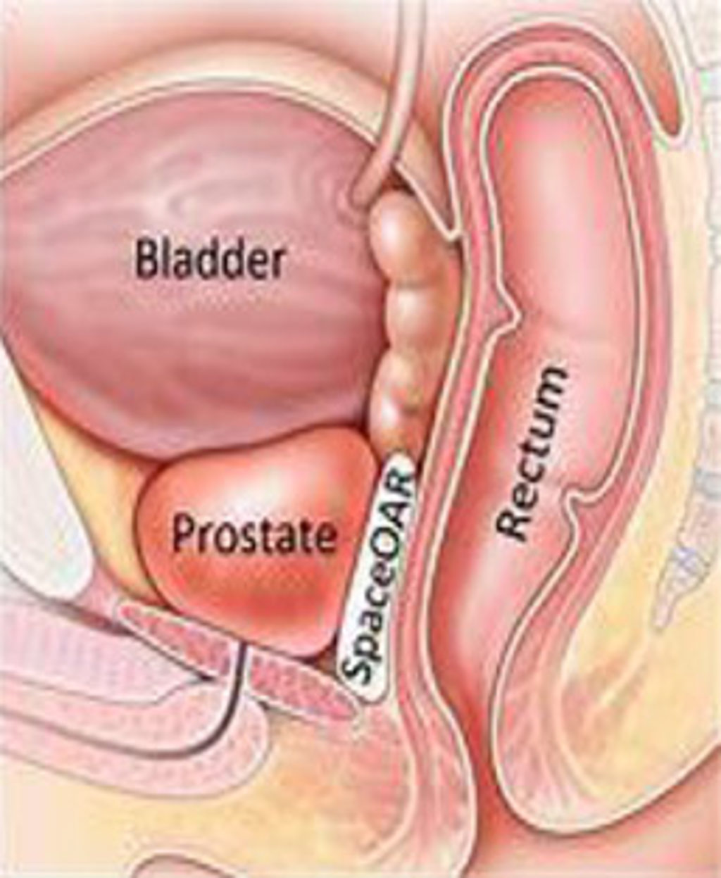 Bladder and Prostrate diagram