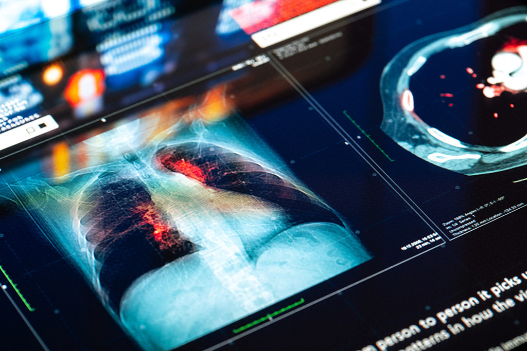 Nuclear Medicine at Penn Highlands Helathcare